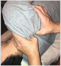 レントゲンの写真